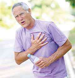 Факторы риска ишемической болезни сердца.